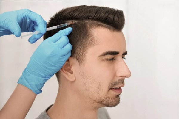 traşsız saç ekimi 5